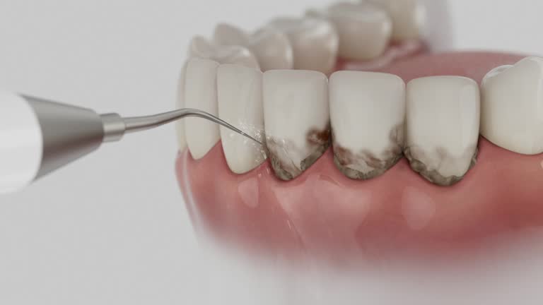 Reliable Dental Implants contractor in Wahoo, NE by Smile Center Dentistry